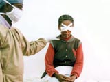 A young woman receives follow-up, after trachoma surgery
